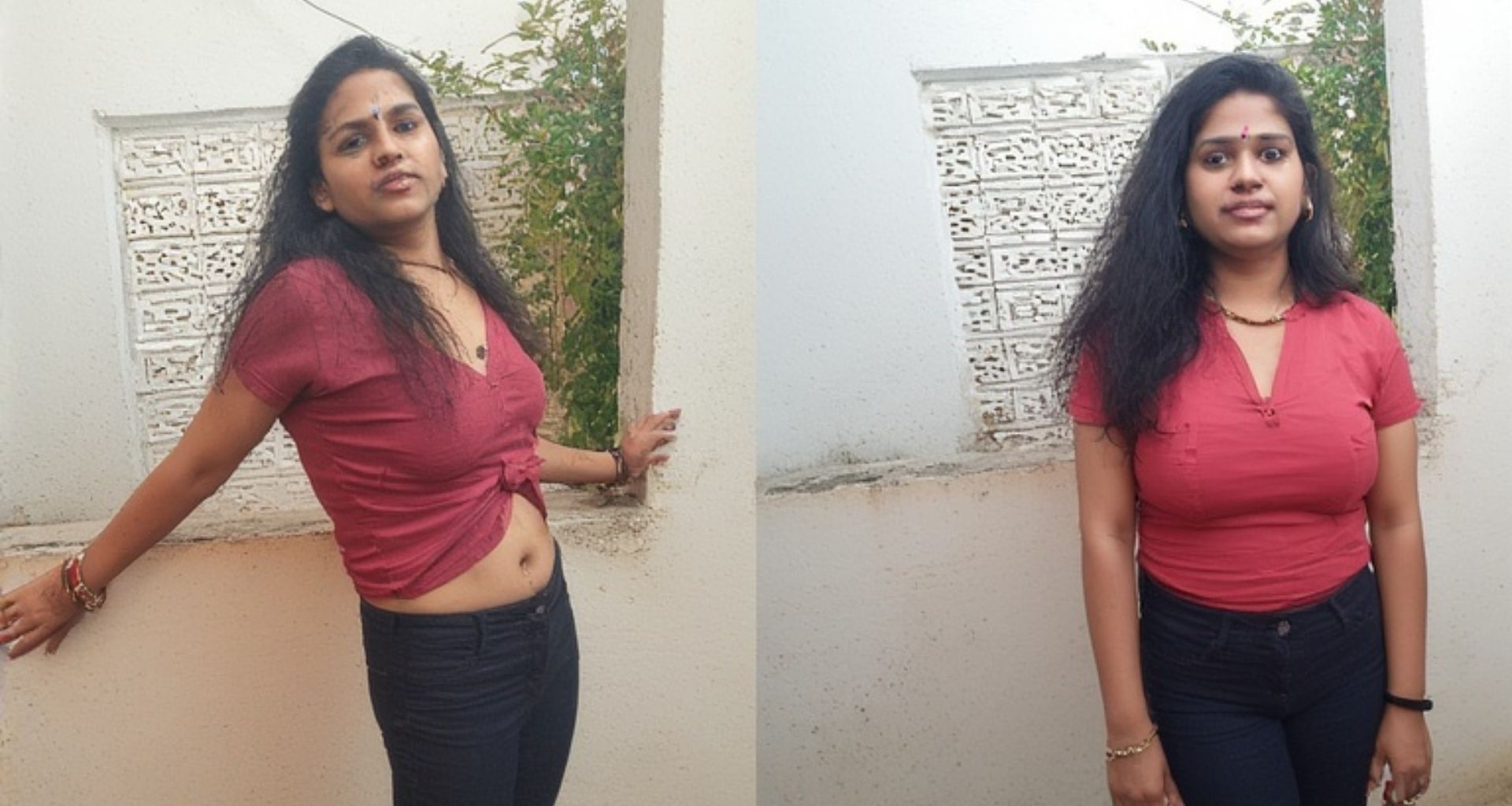 Transgender Surgery in Kolkata
